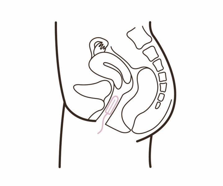 Så ska den sitta. När tampongen sitter rätt, ska du knappt känna den. Gör du det, ta ut den och testa med en ny, kanske en mindre storlek.