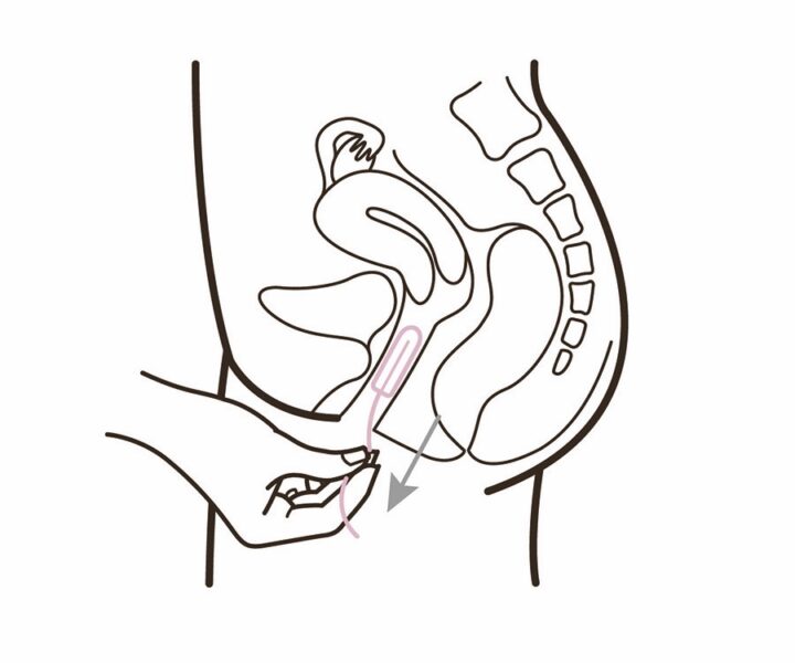 Byt & ta ut. Byt tampong efter 4-6 timmar (max 8). Dra försiktigt i snöret för att ta ut den. Släng tampongen i papperskorgen - inte i toaletten.